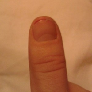 sore thumb crafting sadness